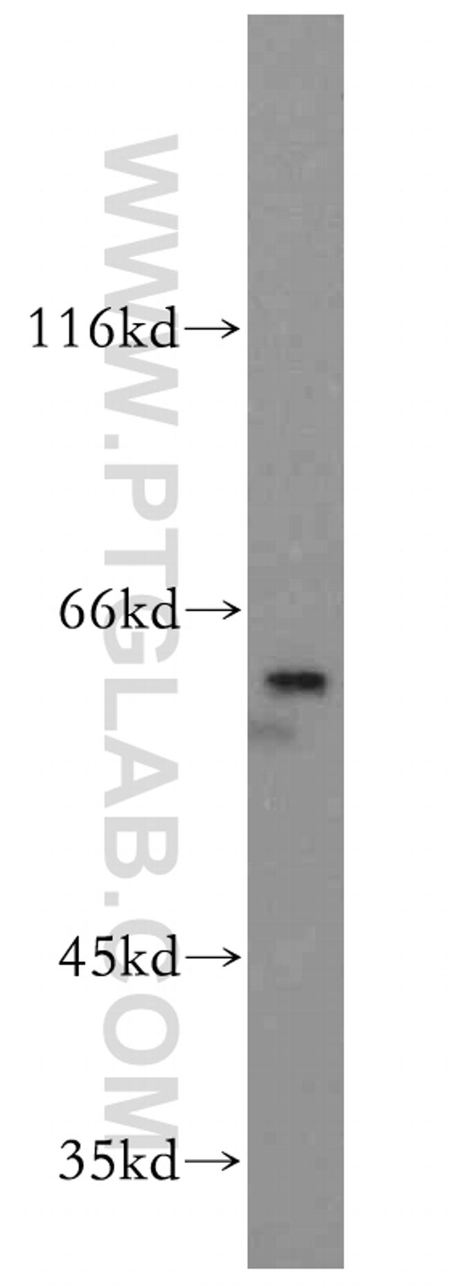 PTBP1 Antibody in Western Blot (WB)