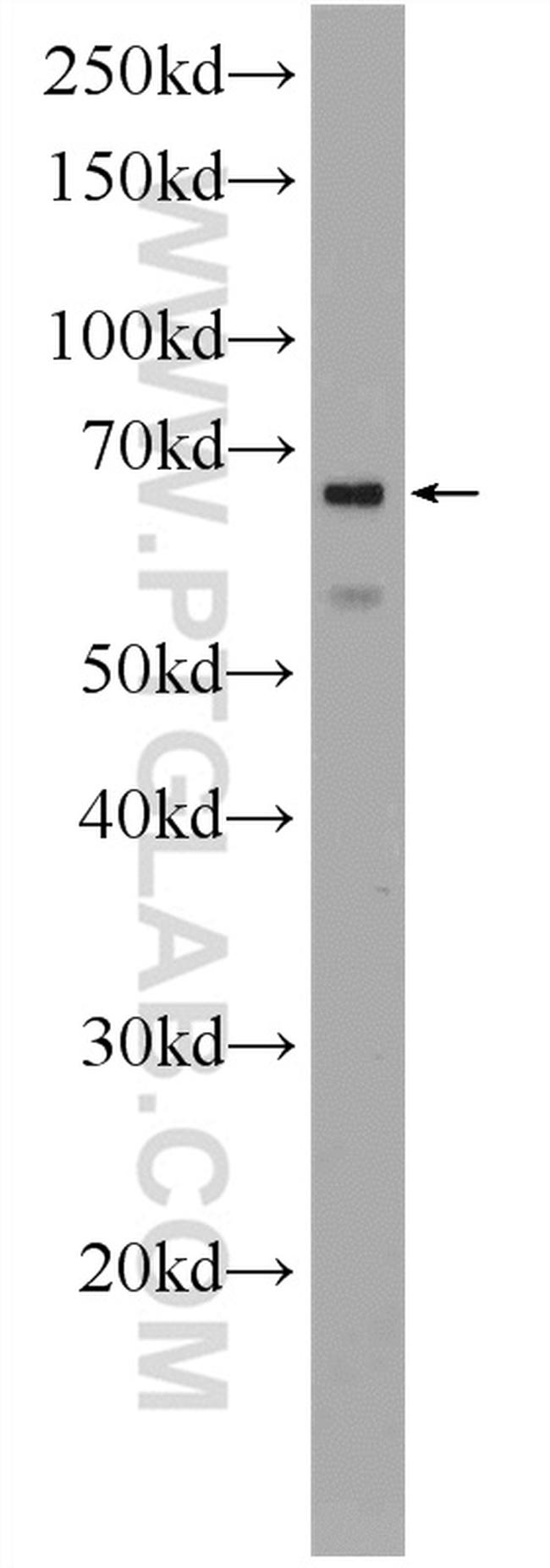 PTBP1 Antibody in Western Blot (WB)