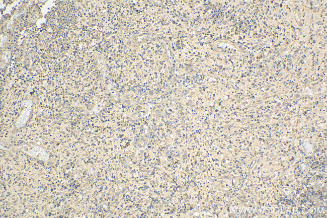 ARHGAP29 Antibody in Immunohistochemistry (Paraffin) (IHC (P))