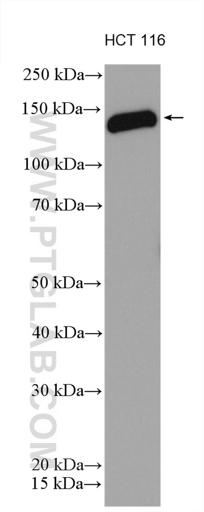 ARHGAP29 Antibody in Western Blot (WB)