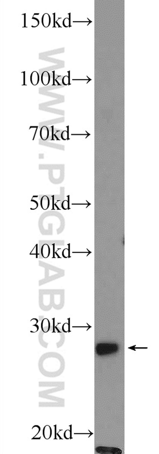 THAP1 Antibody in Western Blot (WB)