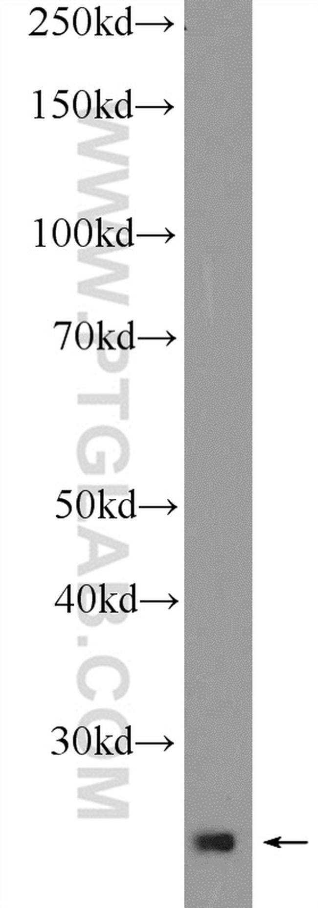 THAP1 Antibody in Western Blot (WB)