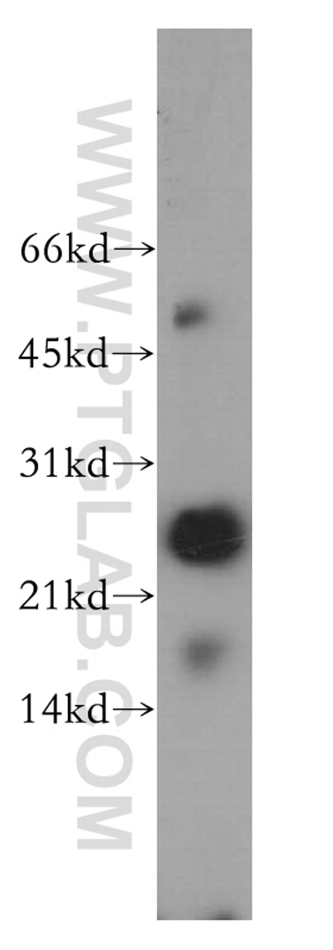 THAP1 Antibody in Western Blot (WB)