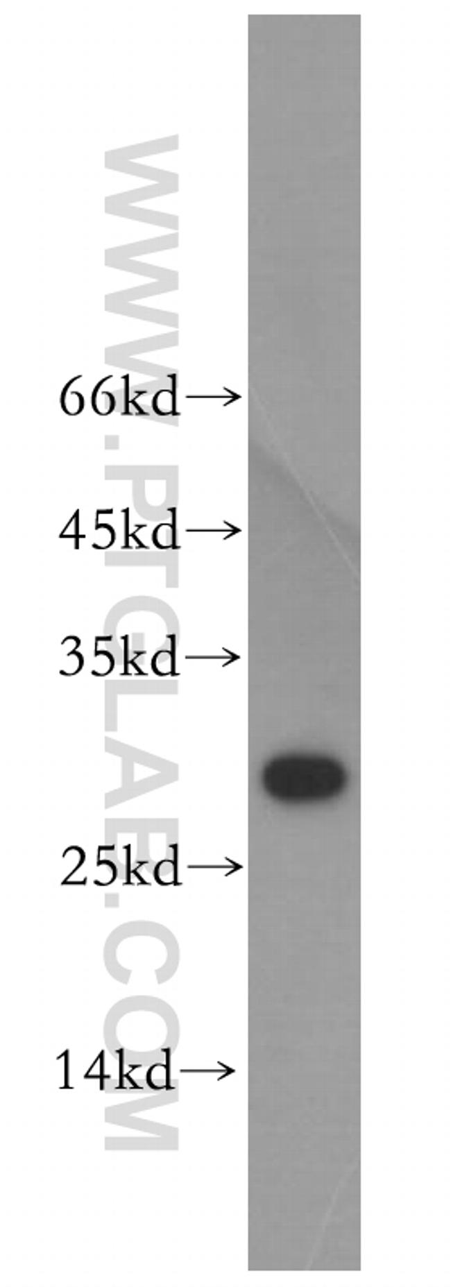 THAP1 Antibody in Western Blot (WB)