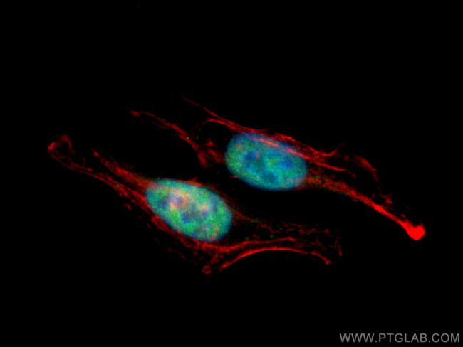 SAMHD1 Antibody in Immunocytochemistry (ICC/IF)