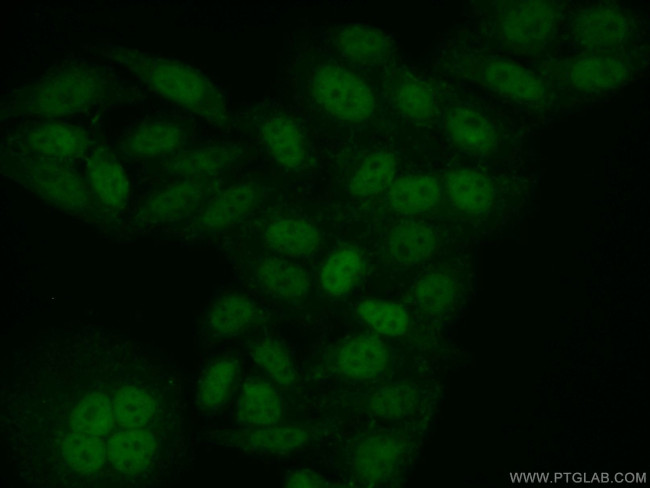 SAMHD1 Antibody in Immunocytochemistry (ICC/IF)