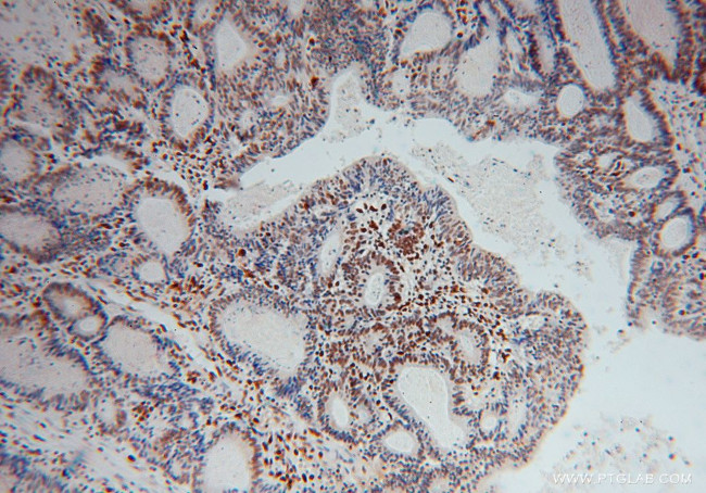 SAMHD1 Antibody in Immunohistochemistry (Paraffin) (IHC (P))