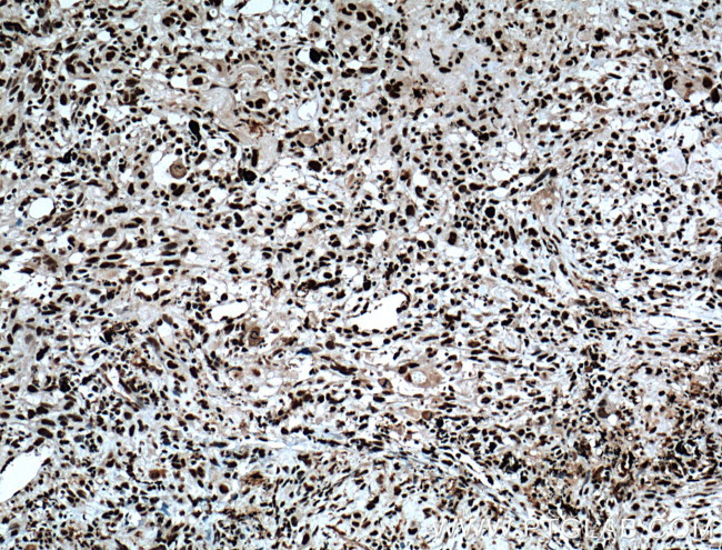 SAMHD1 Antibody in Immunohistochemistry (Paraffin) (IHC (P))