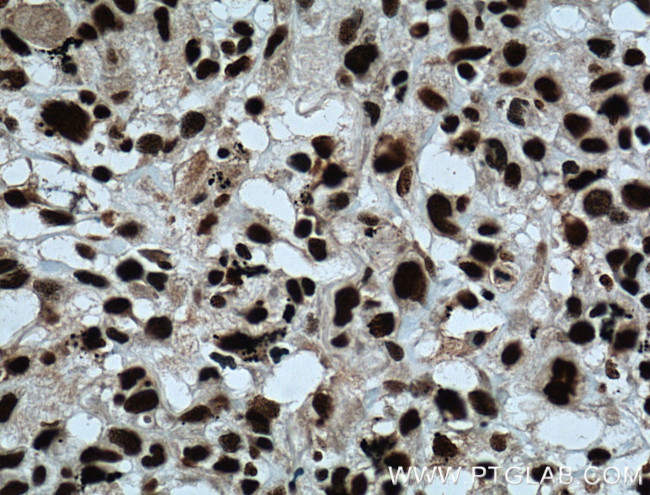 SAMHD1 Antibody in Immunohistochemistry (Paraffin) (IHC (P))