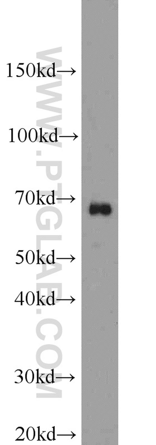 SAMHD1 Antibody in Western Blot (WB)