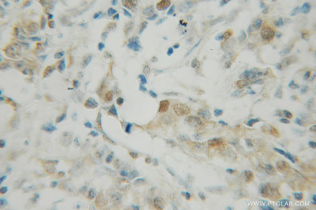 PDCD4 Antibody in Immunohistochemistry (Paraffin) (IHC (P))