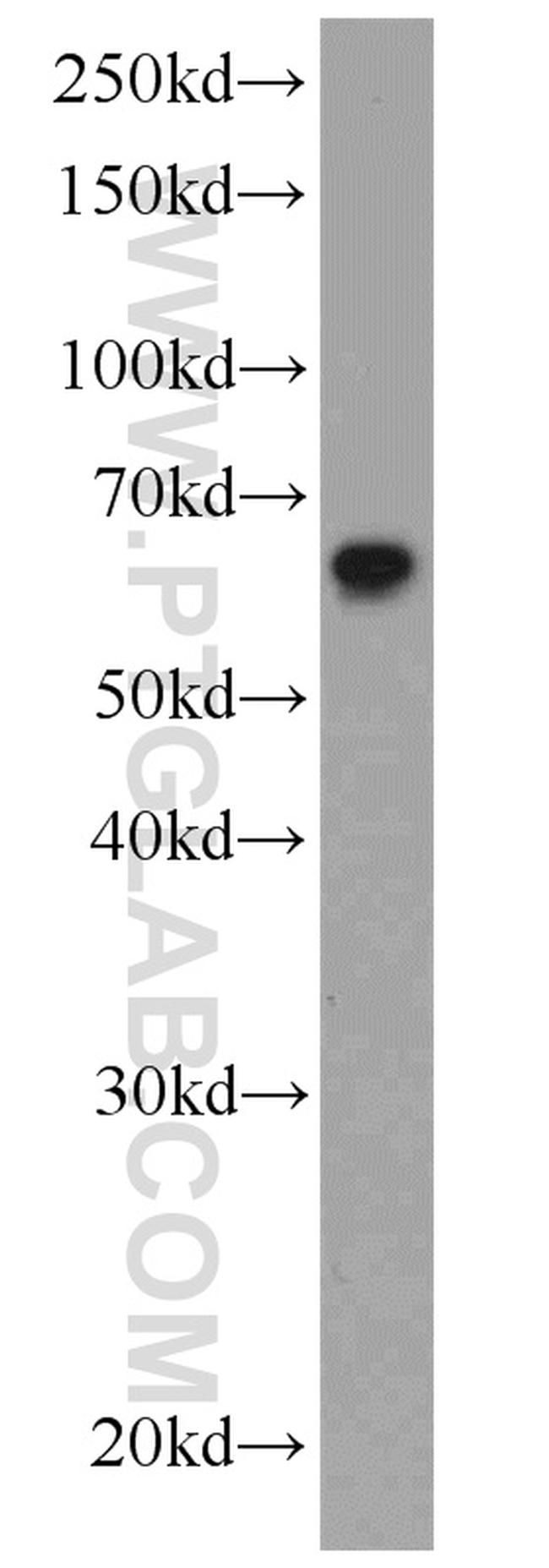 PDCD4 Antibody in Western Blot (WB)