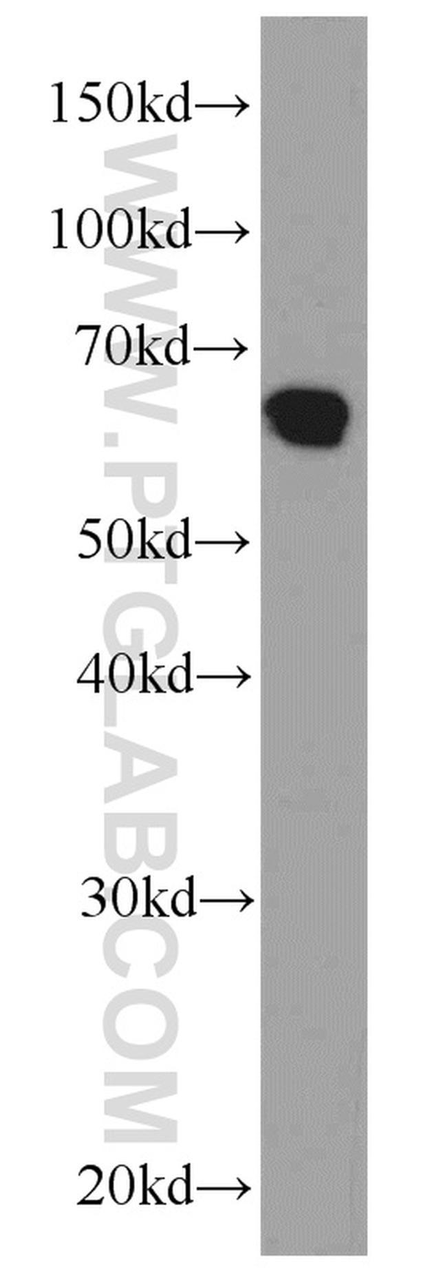 PDCD4 Antibody in Western Blot (WB)