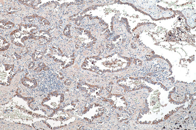 CRABP1 Antibody in Immunohistochemistry (Paraffin) (IHC (P))