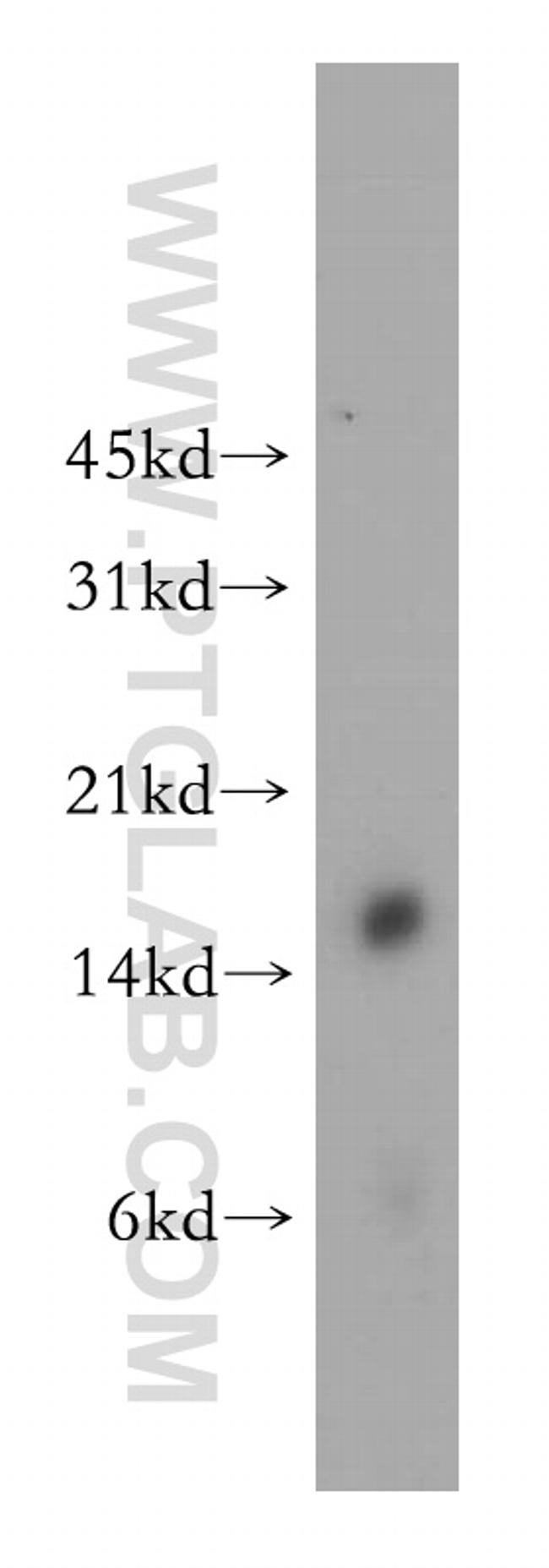 CRABP1 Antibody in Western Blot (WB)