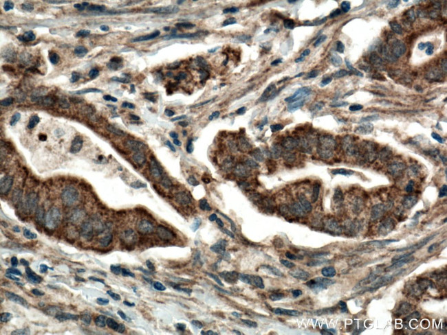 CDO1 Antibody in Immunohistochemistry (Paraffin) (IHC (P))