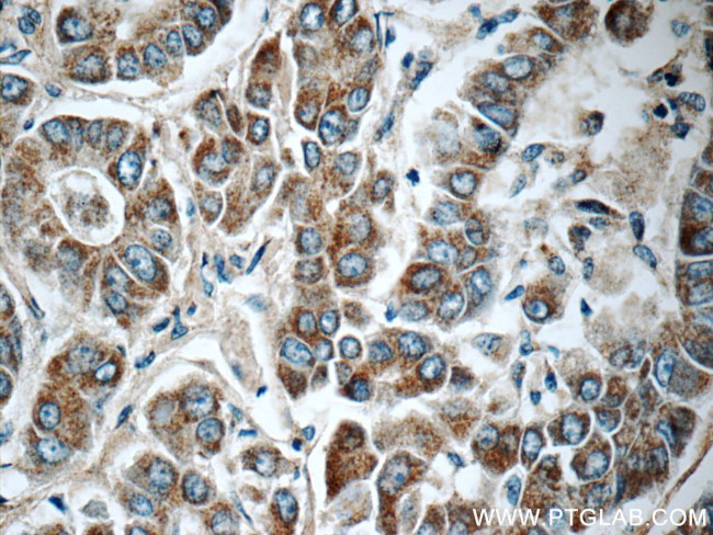 CDO1 Antibody in Immunohistochemistry (Paraffin) (IHC (P))