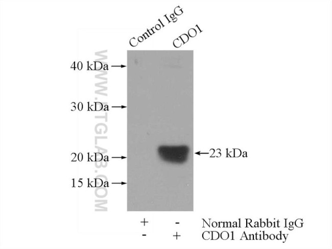 CDO1 Antibody in Immunoprecipitation (IP)