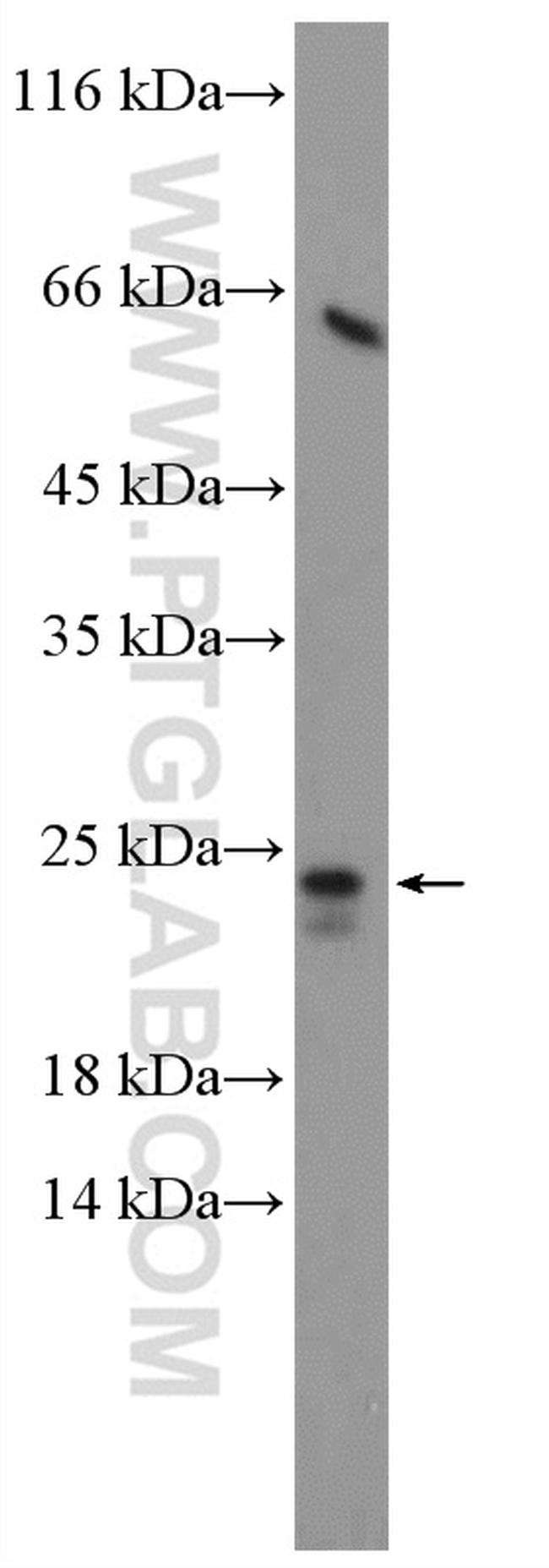 CDO1 Antibody in Western Blot (WB)