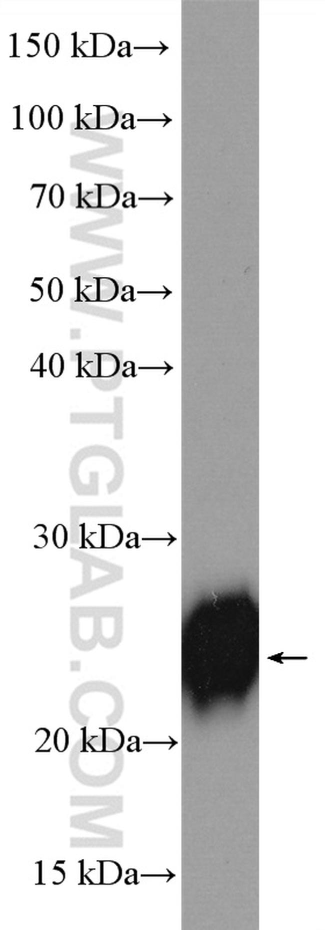 CDO1 Antibody in Western Blot (WB)