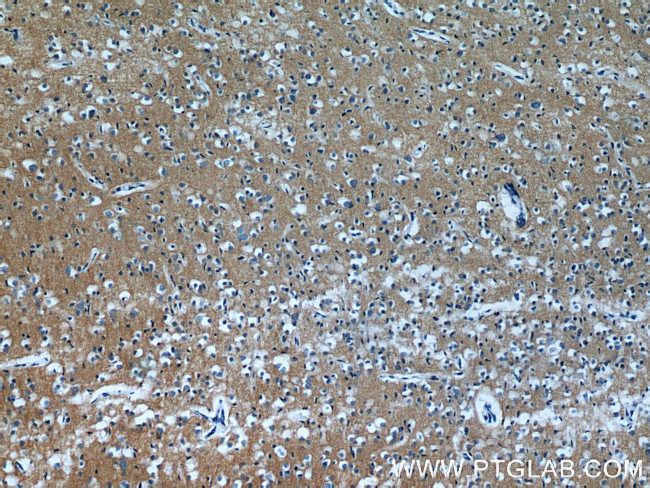 AKAP7 Antibody in Immunohistochemistry (Paraffin) (IHC (P))