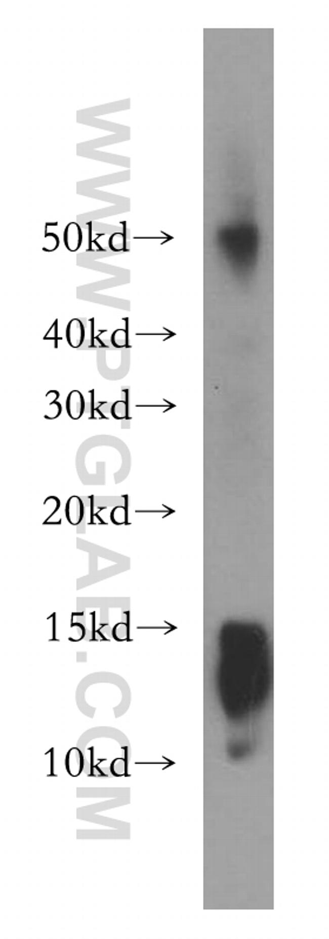 AKAP7 Antibody in Western Blot (WB)