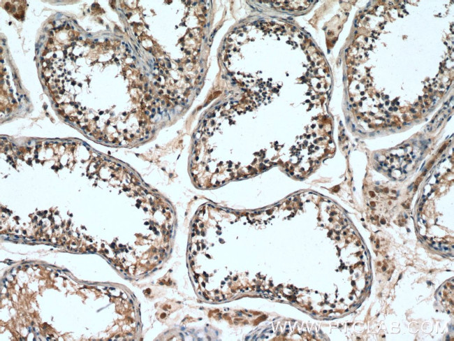 TSGA10 Antibody in Immunohistochemistry (Paraffin) (IHC (P))