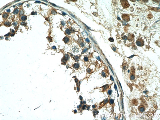 TSGA10 Antibody in Immunohistochemistry (Paraffin) (IHC (P))