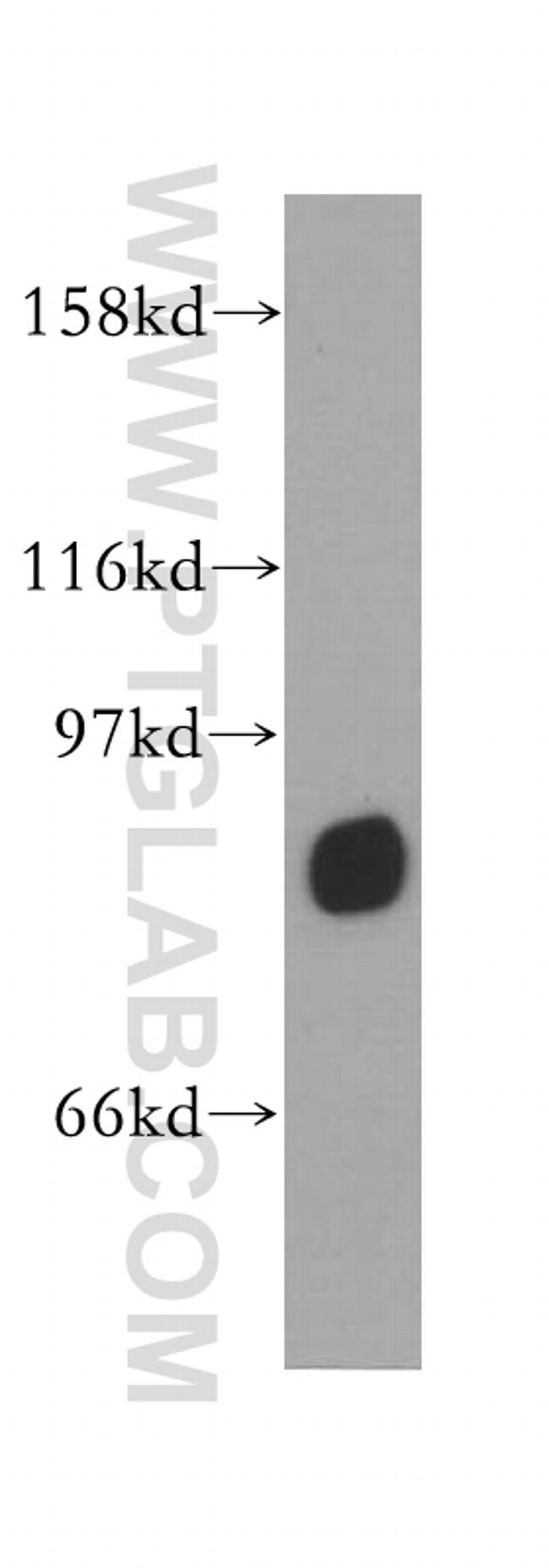 TSGA10 Antibody in Western Blot (WB)