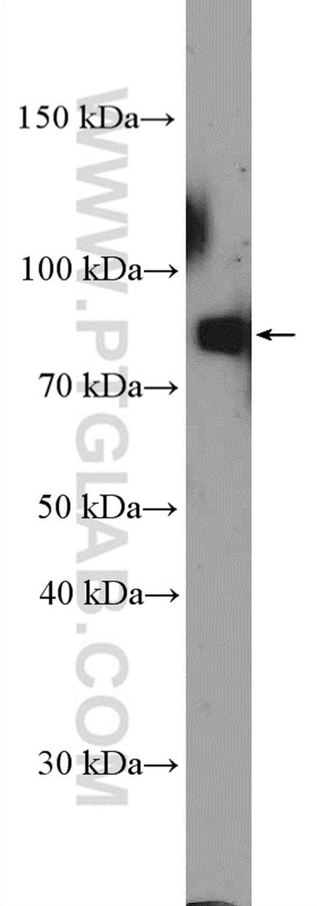 TSGA10 Antibody in Western Blot (WB)