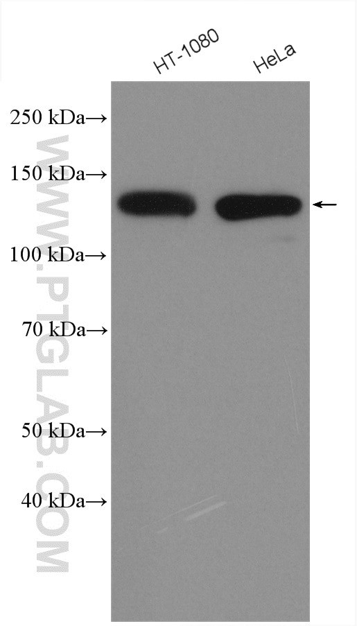Integrin beta-1 Antibody in Western Blot (WB)