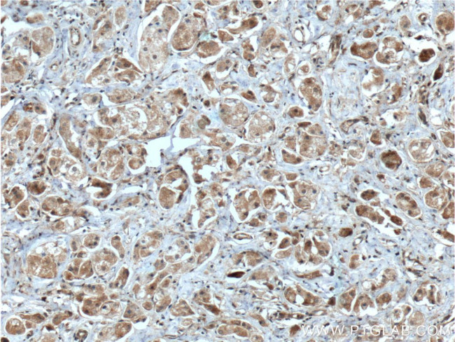 Integrin beta-1 Antibody in Immunohistochemistry (Paraffin) (IHC (P))