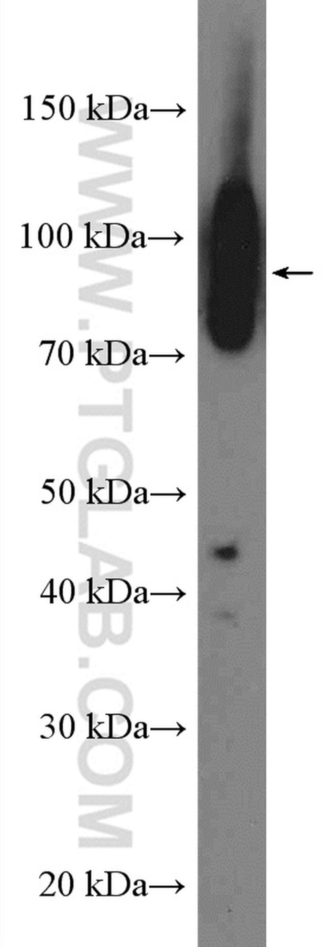 Integrin beta-1 Antibody in Western Blot (WB)