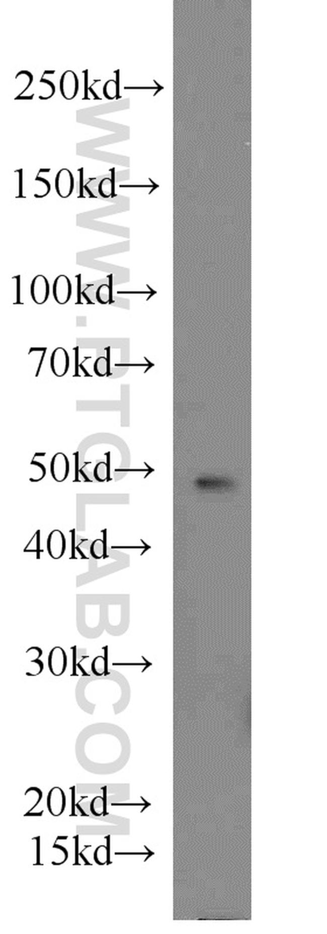 PANX1 Antibody in Western Blot (WB)