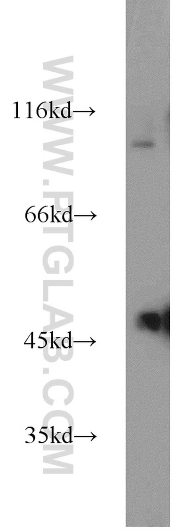 PANX1 Antibody in Western Blot (WB)