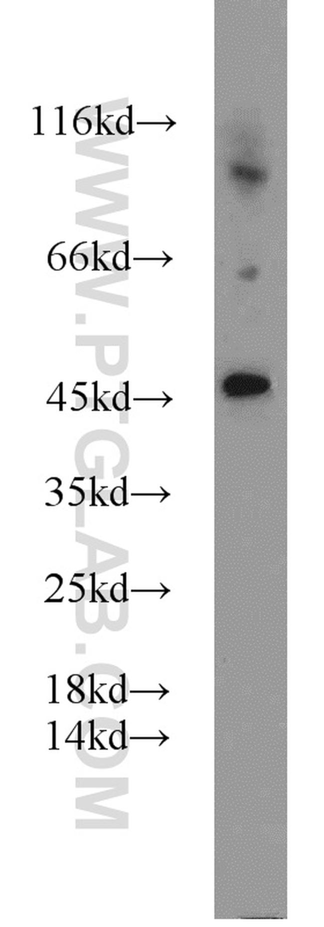 PANX1 Antibody in Western Blot (WB)