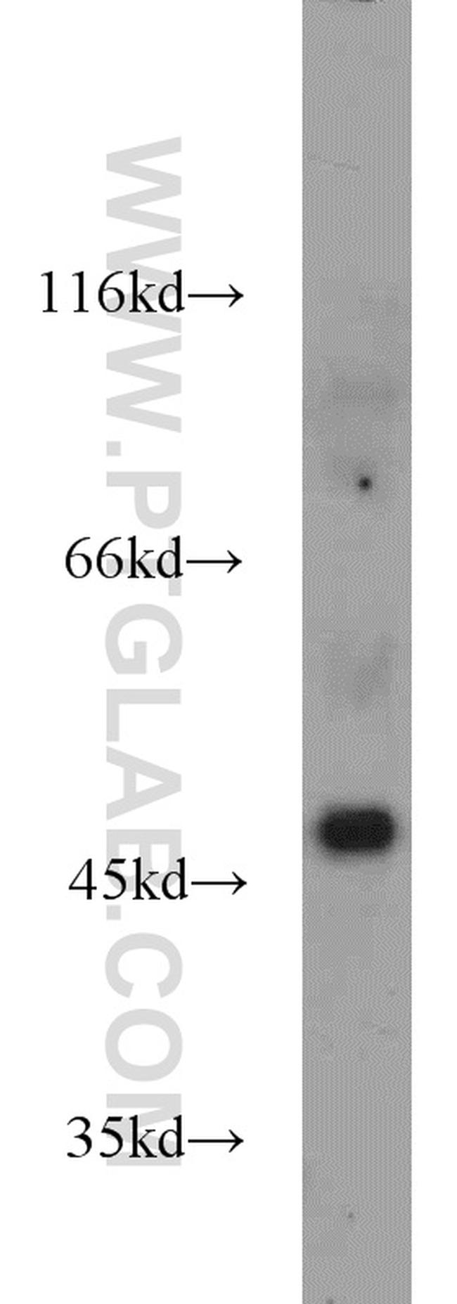 PANX1 Antibody in Western Blot (WB)