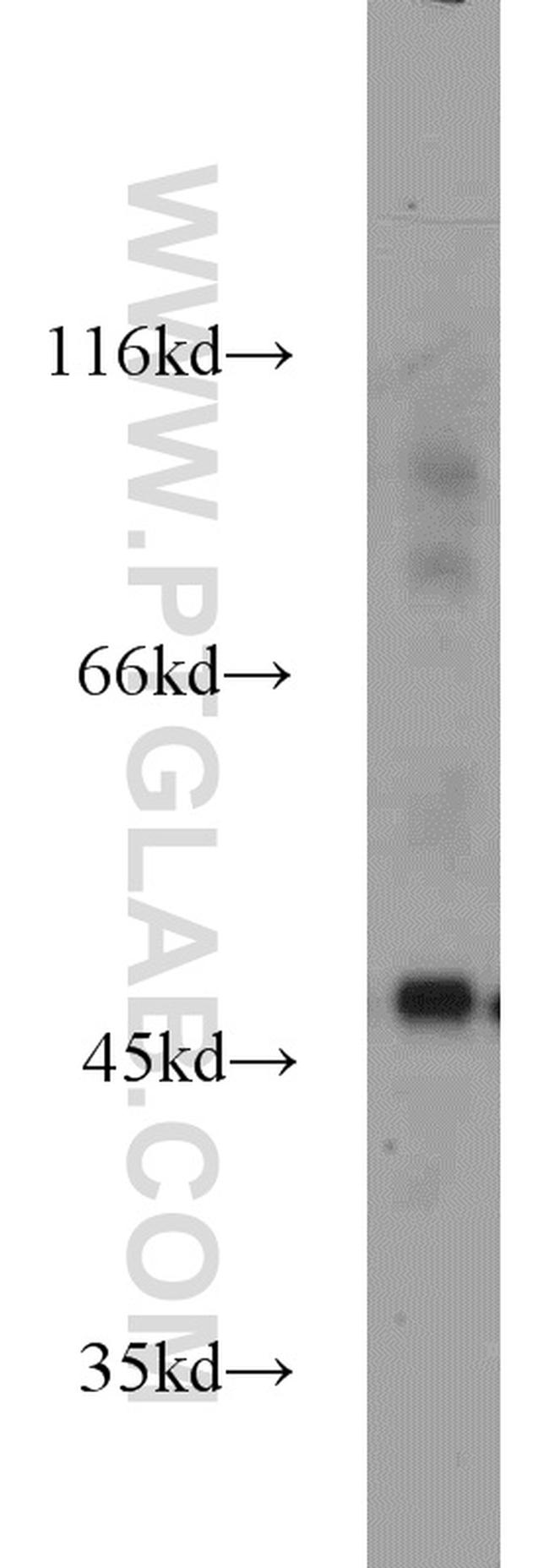 PANX1 Antibody in Western Blot (WB)