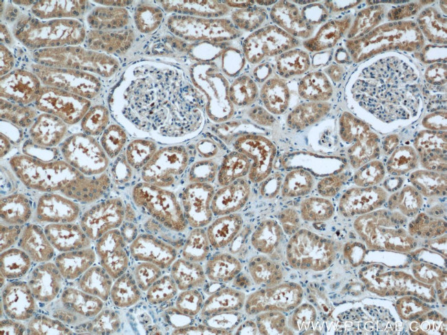 PANX1 Antibody in Immunohistochemistry (Paraffin) (IHC (P))