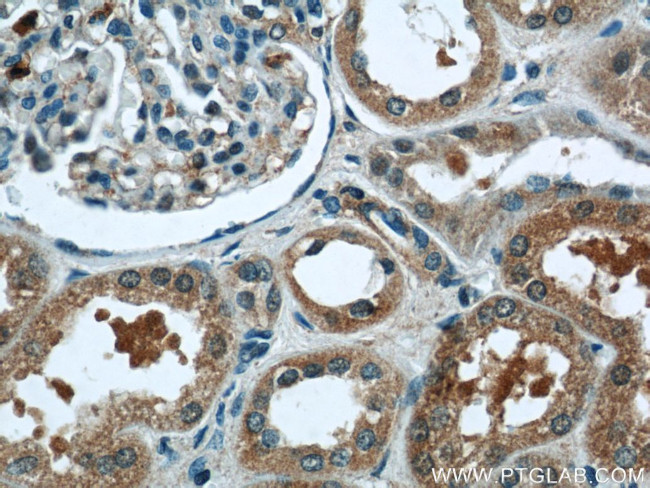 PANX1 Antibody in Immunohistochemistry (Paraffin) (IHC (P))