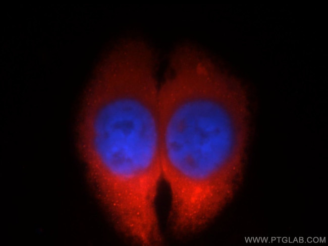 OLFM3 Antibody in Immunocytochemistry (ICC/IF)