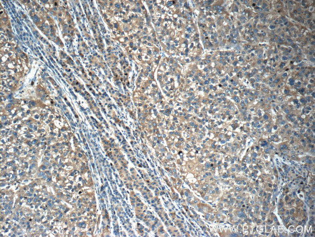 OLFM3 Antibody in Immunohistochemistry (Paraffin) (IHC (P))