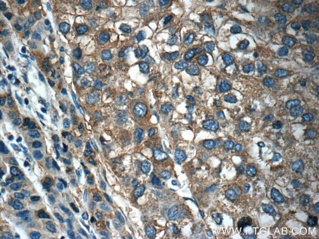 OLFM3 Antibody in Immunohistochemistry (Paraffin) (IHC (P))