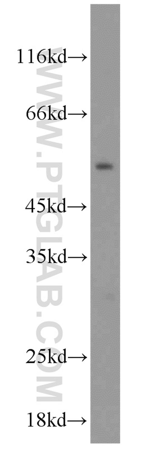 OLFM3 Antibody in Western Blot (WB)