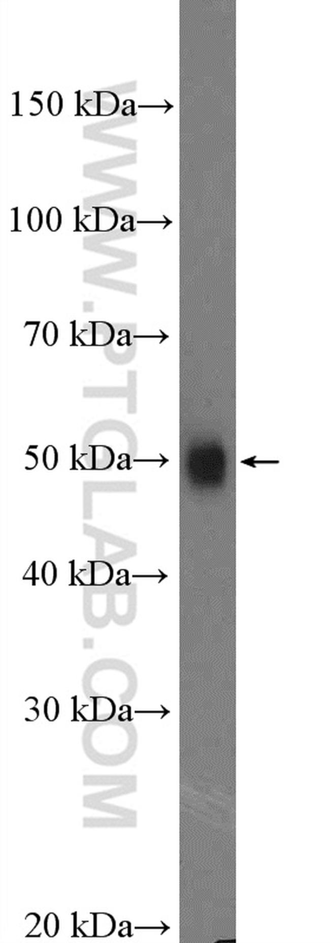 OLFM3 Antibody in Western Blot (WB)