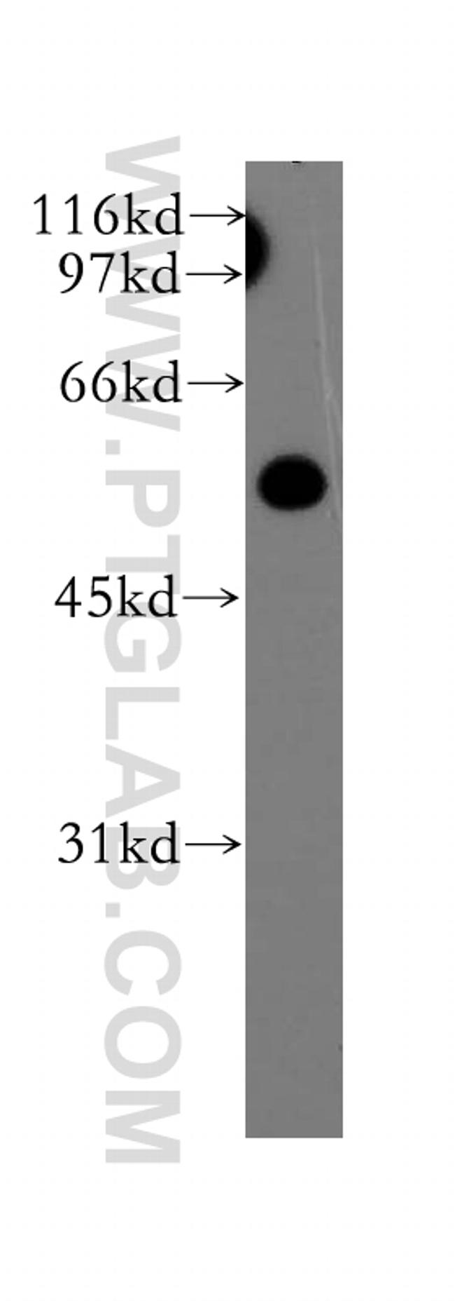 OLFM3 Antibody in Western Blot (WB)