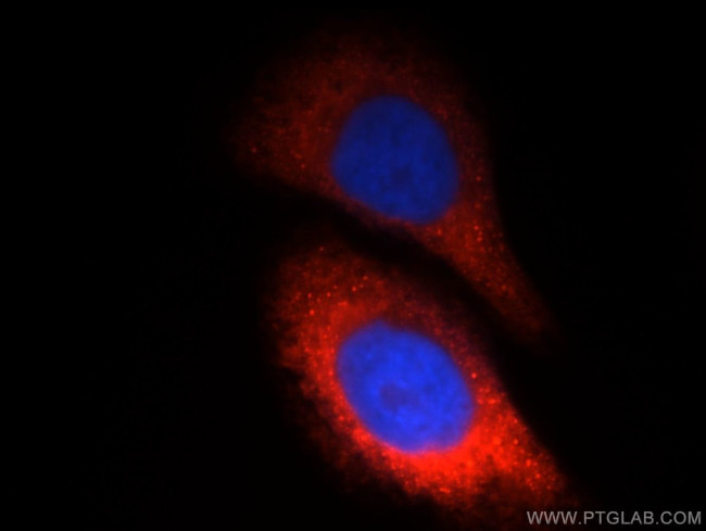 CTBS Antibody in Immunocytochemistry (ICC/IF)