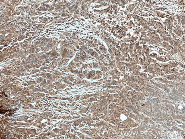 CTBS Antibody in Immunohistochemistry (Paraffin) (IHC (P))