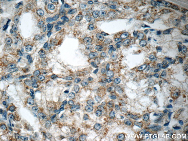 CTBS Antibody in Immunohistochemistry (Paraffin) (IHC (P))