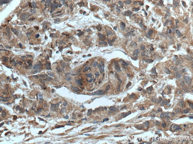 CTBS Antibody in Immunohistochemistry (Paraffin) (IHC (P))